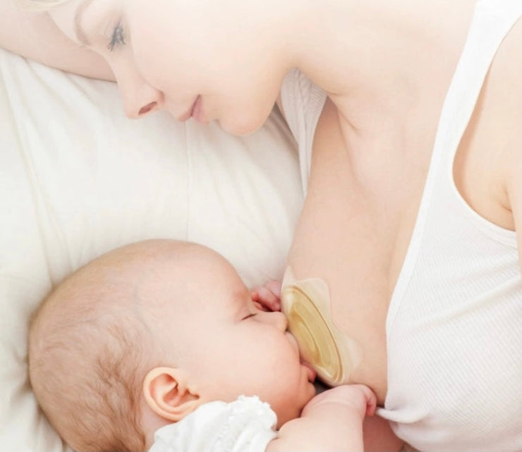 When and How to Use a Nipple Shield for Breastfeeding